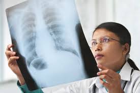 radiologia5